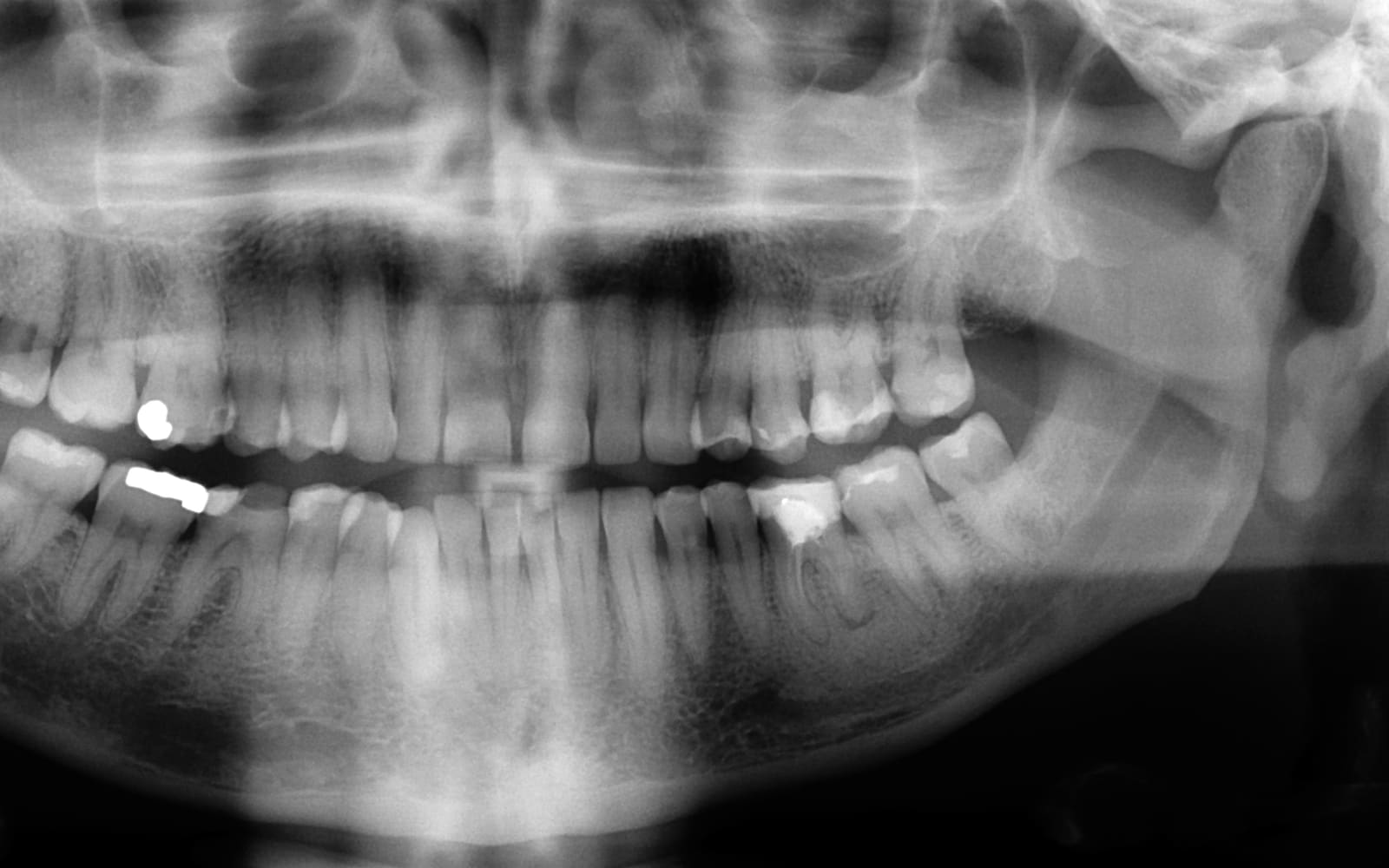 Dentist Near Sector 74 Gurgaon: How to Reach N Square Dental Care Clinic from the SPR-NH-48 Approach