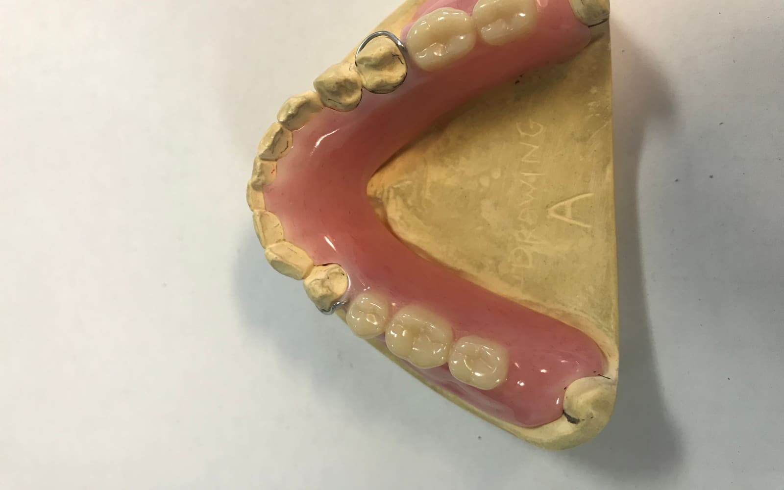 Dentures