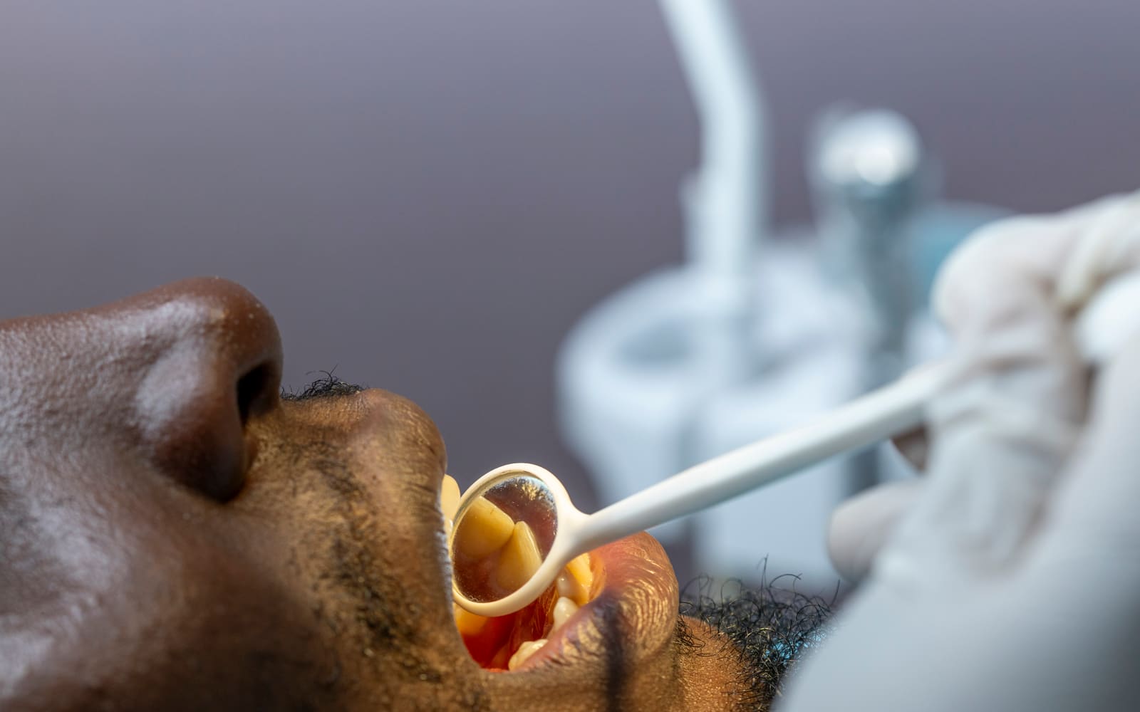 Family Dentist in Gurgaon