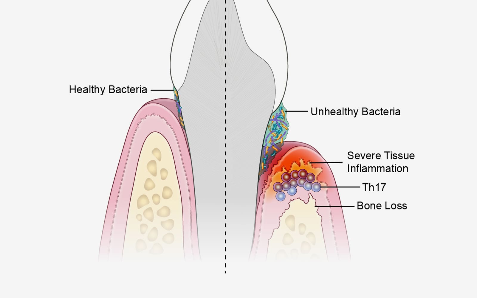 Gum Color Changes: When Dark or Discolored Gums Need a Dental Check in Gurgaon